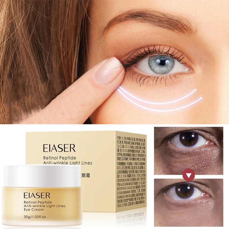 wrinkle removing retinol eye cream improves